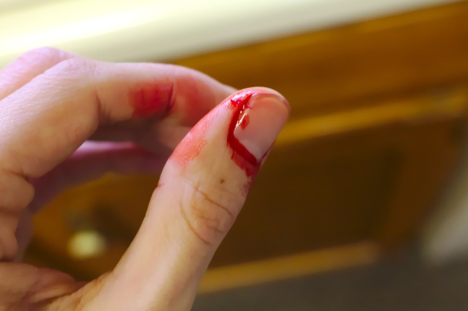 bleeding finger close up